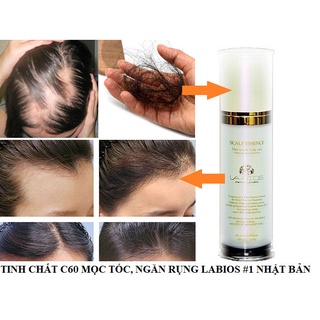 Tinh chất mọc tóc và ngăn rụng tóc Labios Scalp Essence 60ml