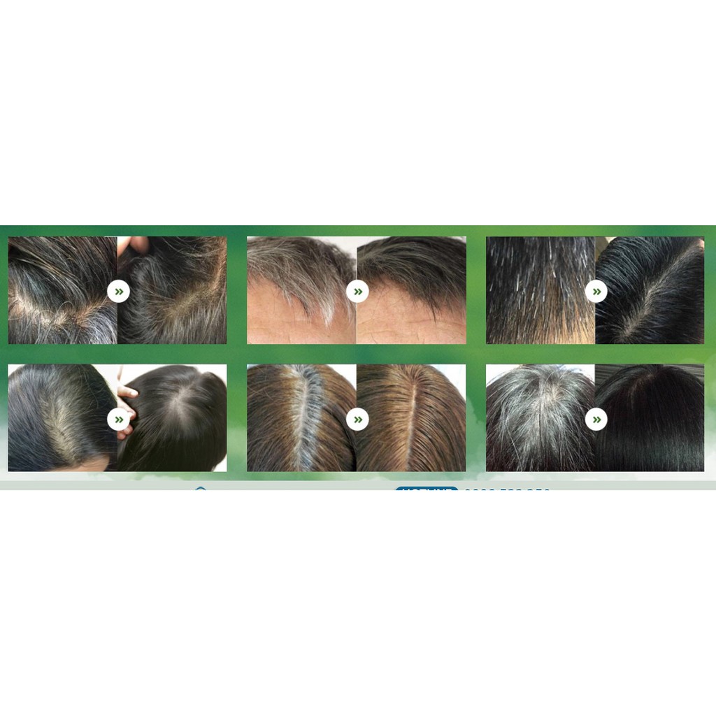 Dầu gội thảo dược Haco 300ml-ngăn ngừa rụng tóc, kích thích sự phát triển của nang tóc/Hàng chính hãng | BigBuy360 - bigbuy360.vn