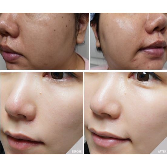 tiam panthenol moist cream