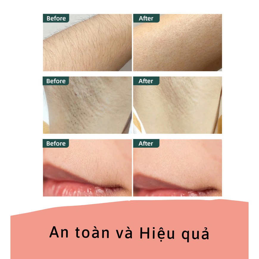 [Amazon Best Seller] Máy Triệt Lông Lạnh chuyên dùng cho Spa,Công Nghệ Làm Lạnh Đầu Triệt,Triệt Mát Lạnh, Không Nóng Rát