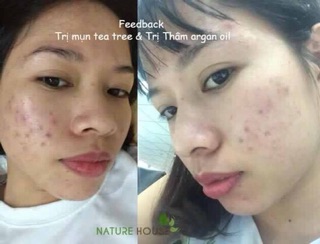 Bộ tea tree argan oil