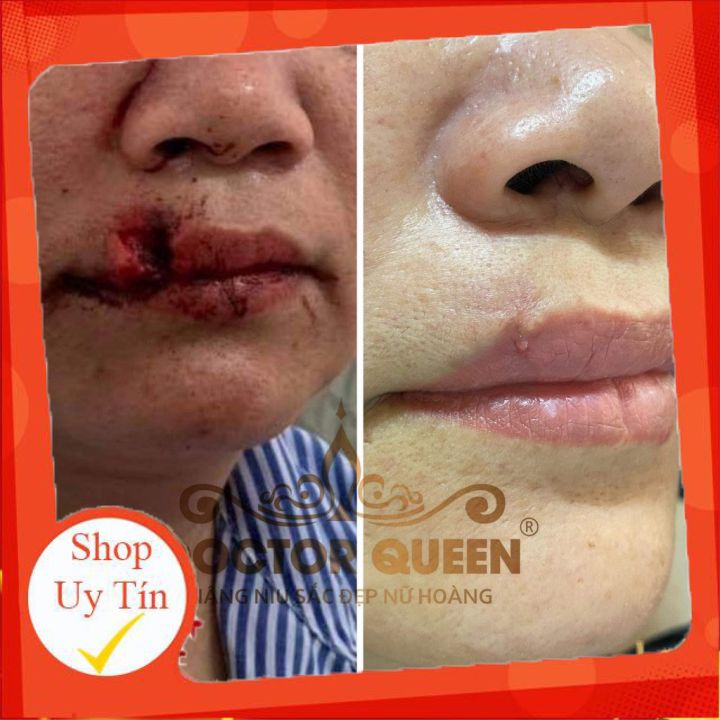 CAO NGHỆ DOCTORQUEEN 🔥𝐍𝐄𝐖🔥