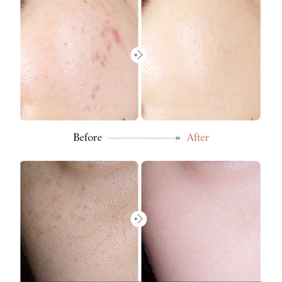 Ảnh thật 🍀 Kem che khuyết điểm HỒNG HOA BELLEMYSTERY nội địa che phủ tốt lâu trôi đều màu sỉ rẻ - GIÁ GỐC 12 | BigBuy360 - bigbuy360.vn