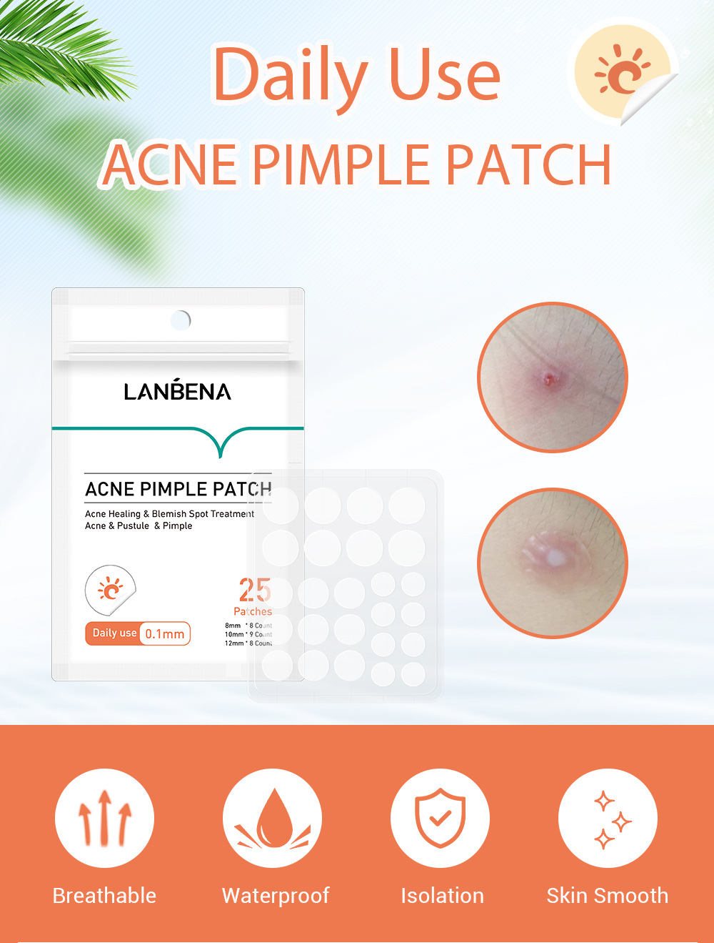 Bộ 25 miếng dán hỗ trợ giảm mụn che khuyết điểm trong suốt LANBENA | BigBuy360 - bigbuy360.vn