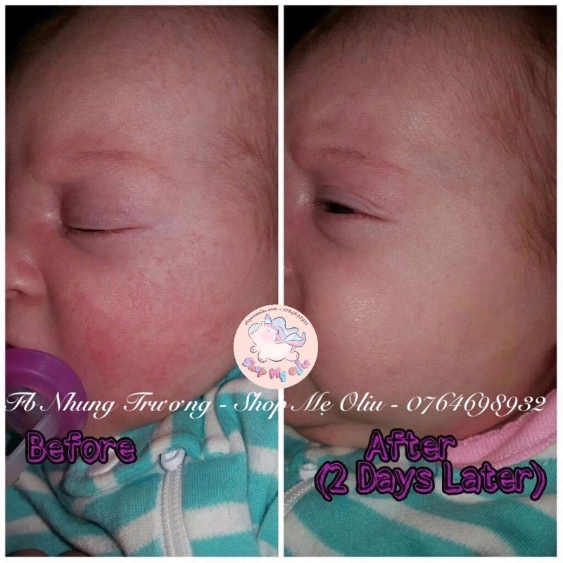 Xịt BabyBiotics chăm sóc da cho bé dung tích 120ml