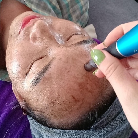 Máy phi kim Dr pen tích điện, máy lăn kim cấy trắng da mặt cấy tảo xoắn chính hãng