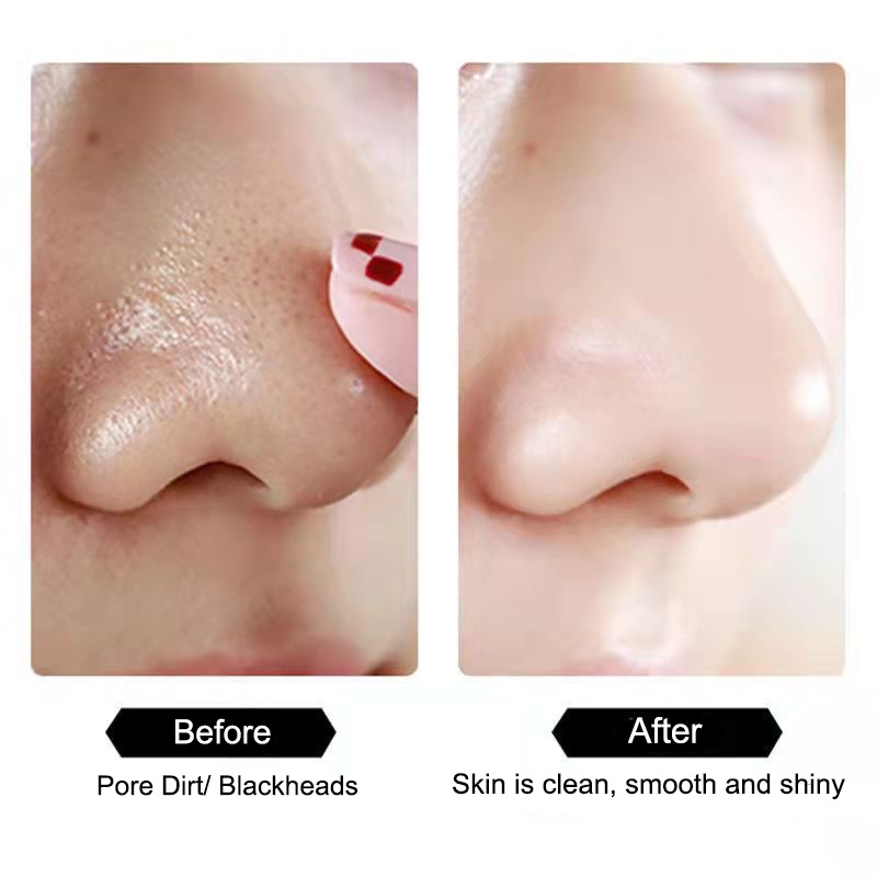 Mặt Nạ Ngủ Oligopeptide Sủi Bọt Dưỡng Ẩm Làm Sạch Lỗ Chân Lông