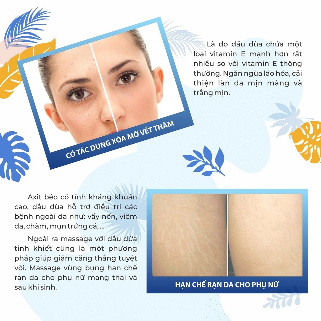 Dầu dừa dưỡng tóc nguyên chất ép lạnh tinh khiết Vietcoco , Dầu dừa Vietcoco Vitamin E