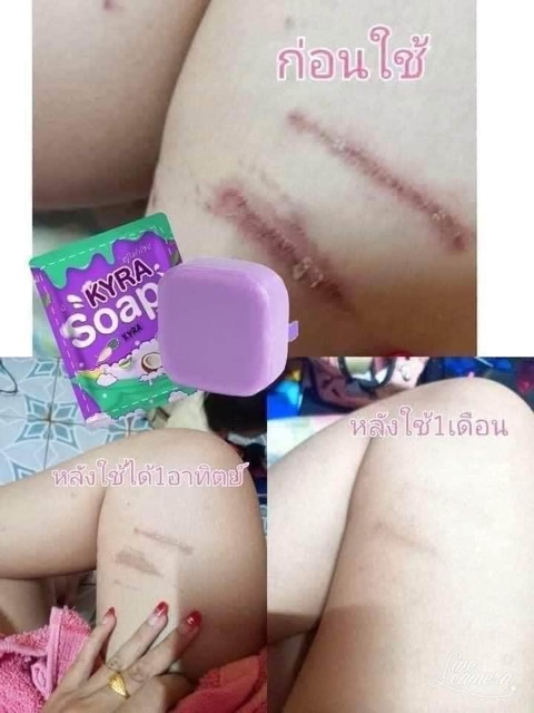 Xà Phòng Kyra Soap Trắng Da Body & Face | BigBuy360 - bigbuy360.vn