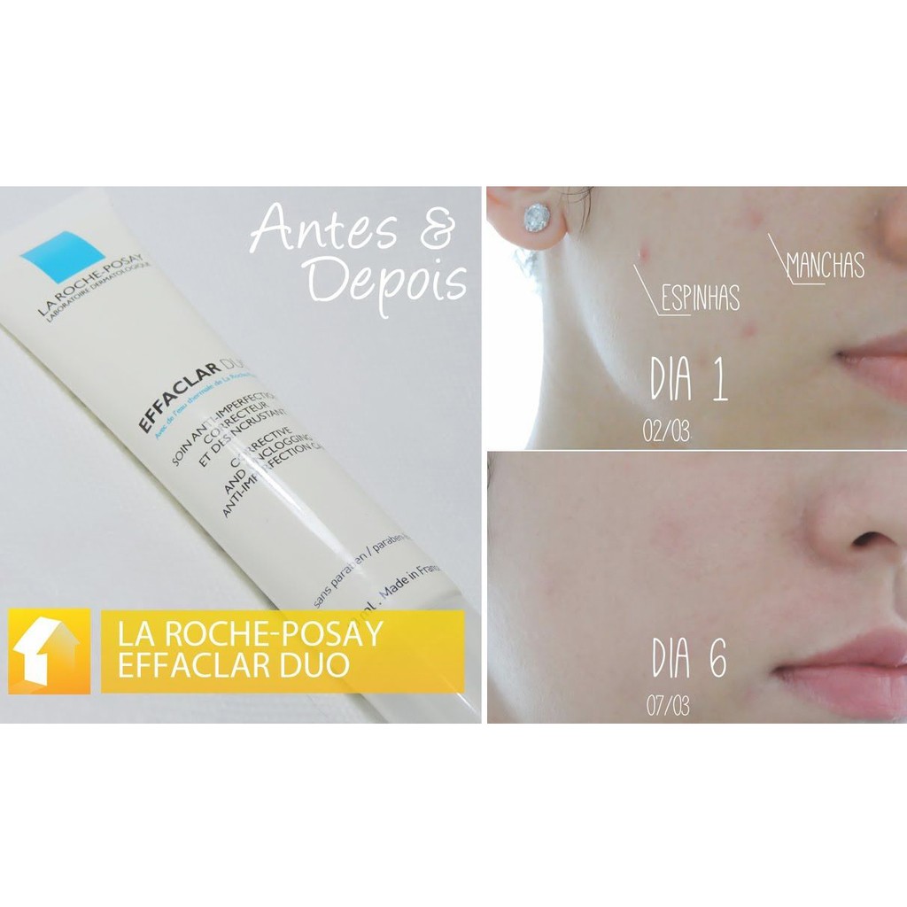 Kem trị mụn, giảm mụn La Roche-Posay Effaclar Duo+ (40ml)