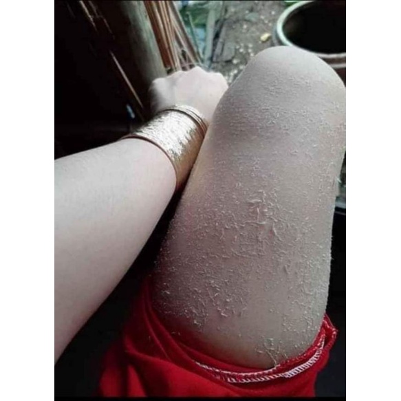 Kem bong da tái tạo DH White Vip hủ 100k ❤ freeship ❤