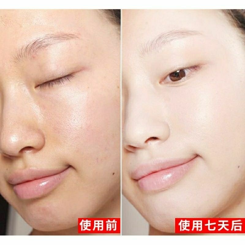 Tinh chất VC VC dưỡng ẩm làm trắng da thu nhỏ lỗ chân lông làm sáng da hiệu quả qiaoshusheng.11.3 | BigBuy360 - bigbuy360.vn