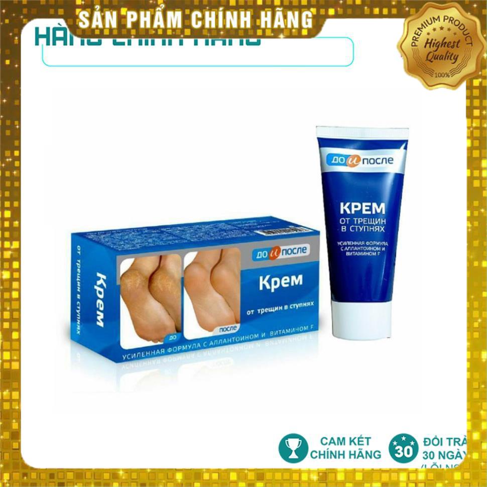 [ Hàng Chính Hãng] Kem Nứt Gót Chân Kpem Nga 50ml