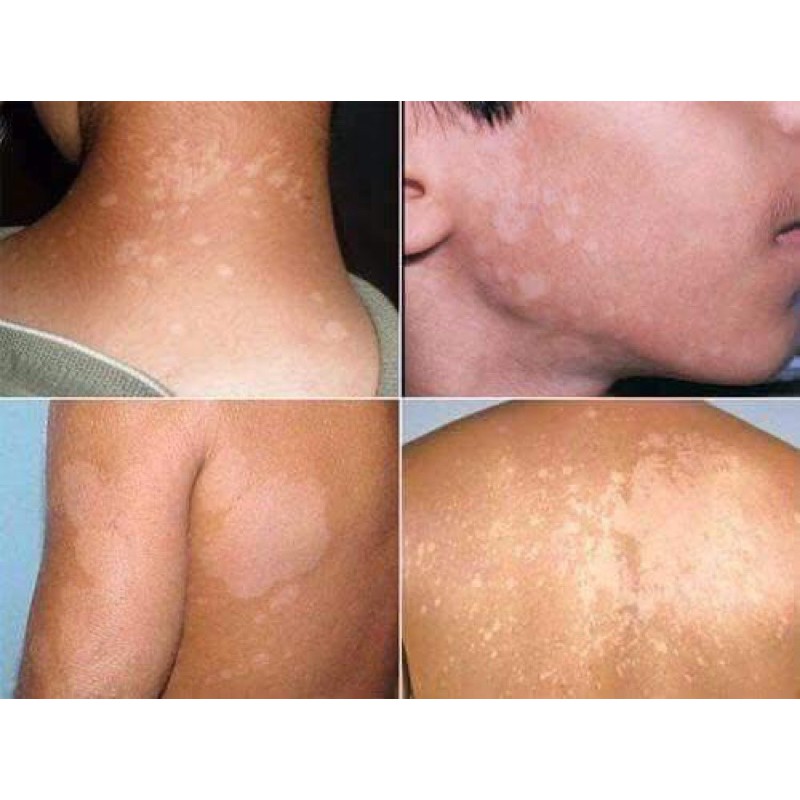 KEM BÔI LANG BEN  THÁI LAN