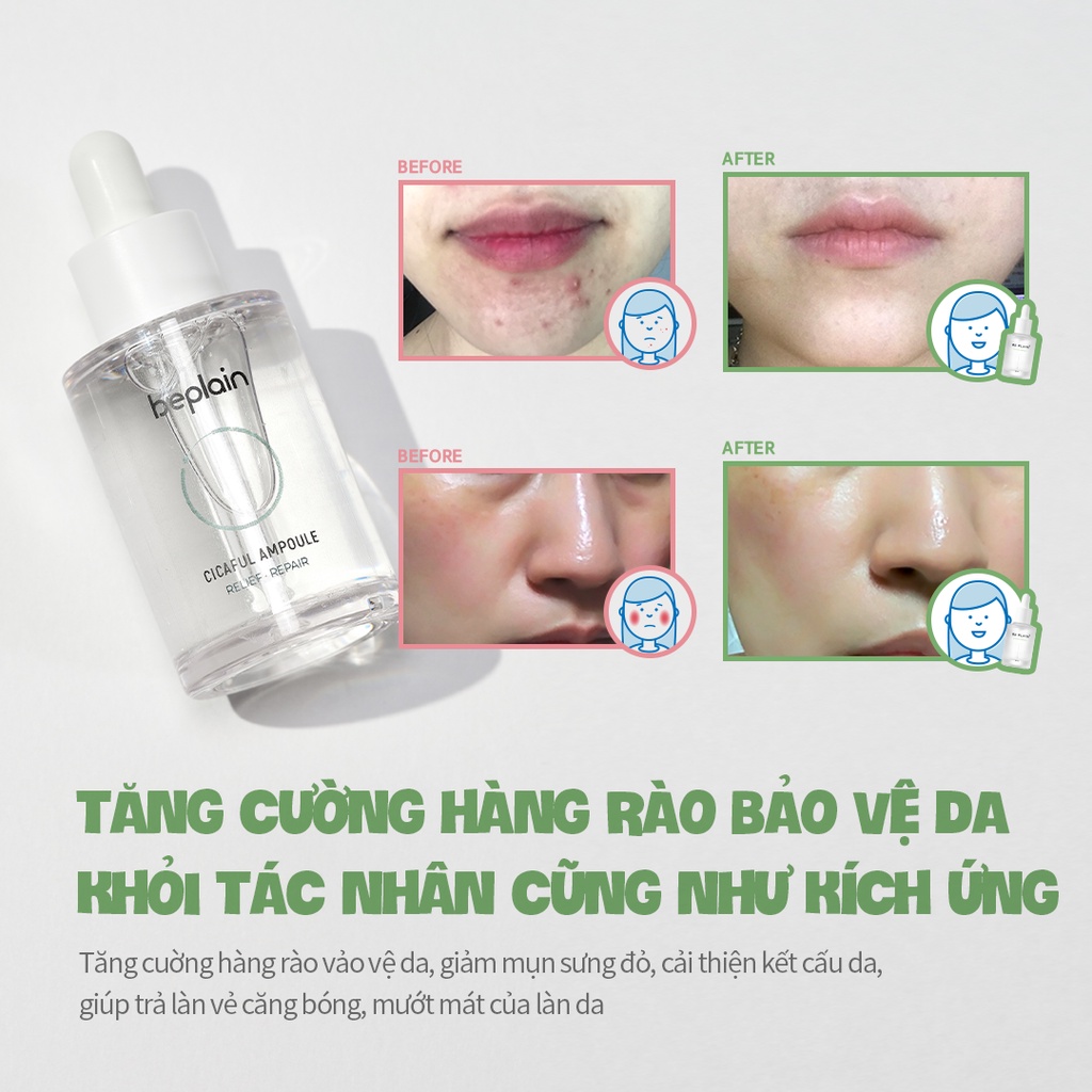 Set Tinh chất beplain Rau Má Cicaful thế hệ I (chứa thành phần gạo lên men) (50ml + 20ml)