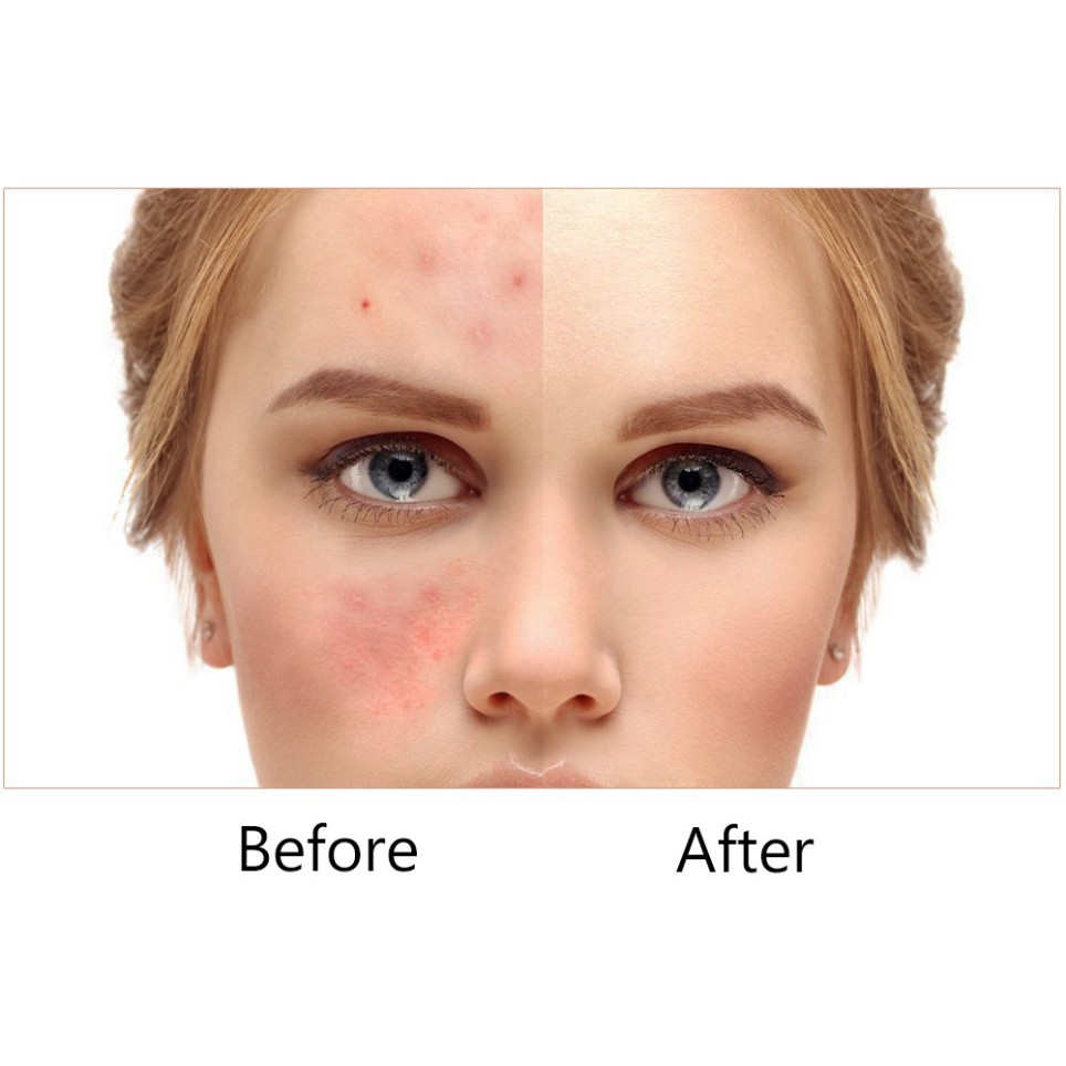 Sale 69% Kem che khuyết điểm hoàn hảo thương hiệu O.TWO.O, 4 Giá gốc 56000đ- 20F9-5 | BigBuy360 - bigbuy360.vn