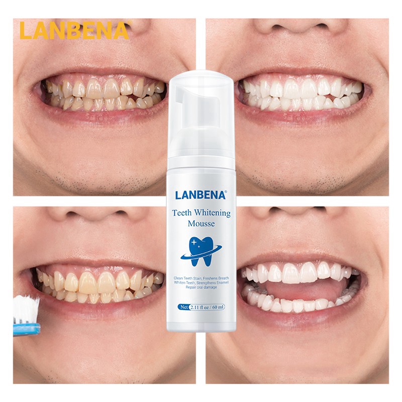 LANBENA Teeth Whitening Mousse Freshening Breath 60ml