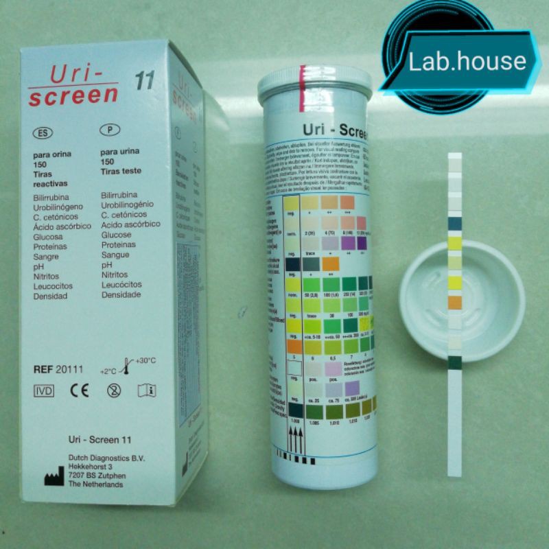 Que thử nước tiểu 11 thông số (phát hiện bệnh lý về đường tiểu)