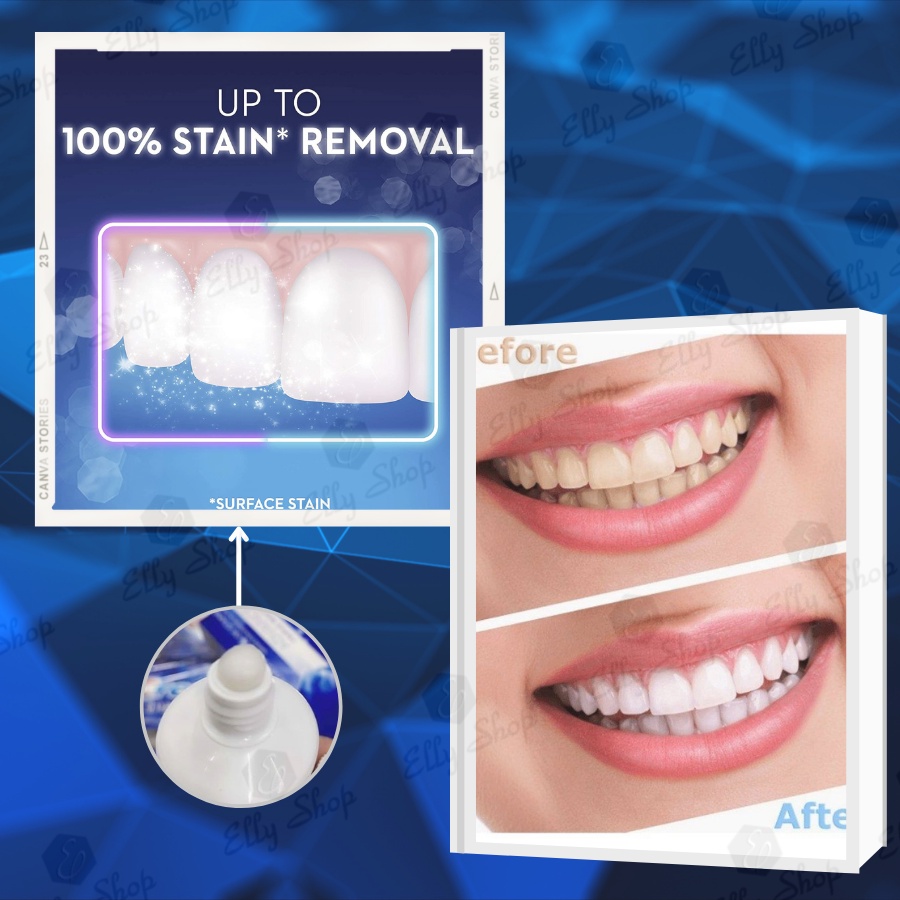 Kem đánh răng Crest 3D White Advanced Triple Whitening - 158g