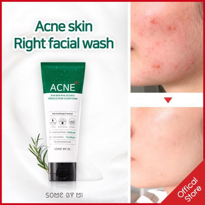 Sữa rửa mặt cho da mụn Some By Mi AHA-BHA-PHA 30 Days Miracle Acne Clear Foam | BigBuy360 - bigbuy360.vn