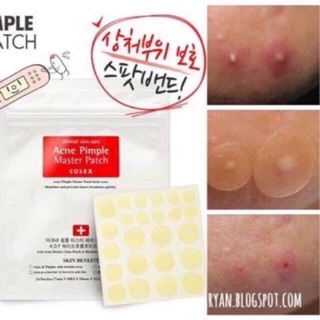 Miếng Dán Mụn Acne Pimple Master Patch Cosrx