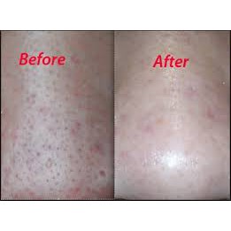 Dung Dịch Loại Bỏ Tế Bào Chết Paula'S Choice Skin Perfecting 2% Bha Liquid Exfoliant 30Ml Mã 2016