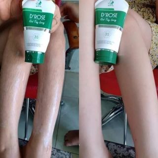 [SIÊU KHUYẾN MÃI] COMBO BỘ ĐÔI TRIỆT LÔNG VĨNH VIỄN + 🎁