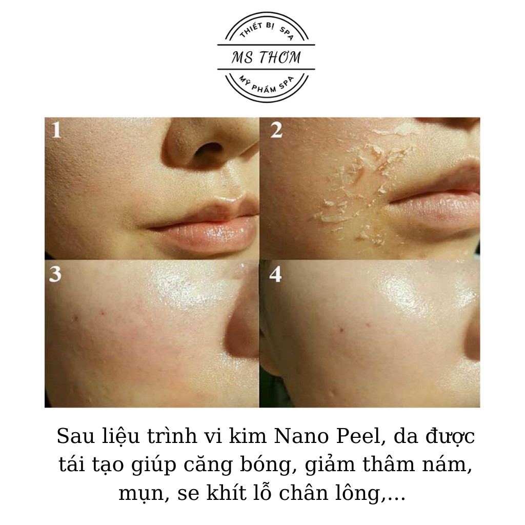 Vi kim tảo biển Nano peel siêu nhỏ giúp tái tạo làn da mới (hộp 6 cặp)