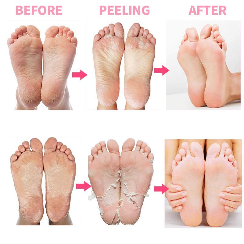 Rose Exfoliating Foot Mask Moisturizing Exfoliation for Legs Heels Remove Dead Skin Pedicure Peeling Feet Mask | BigBuy360 - bigbuy360.vn
