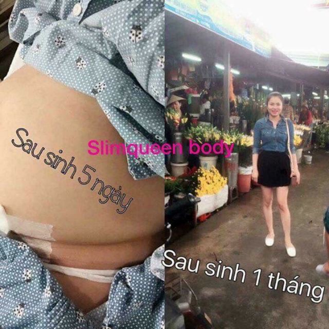 KEM LÀM SĂN CHẮC DA VÙNG BỤNG SLIM QUEEN PERFECT [ HIỀN QUEEN PERFECT ] TẶNG KÈM KEM Ủ MÔI CARE HÀN QUỐC | BigBuy360 - bigbuy360.vn
