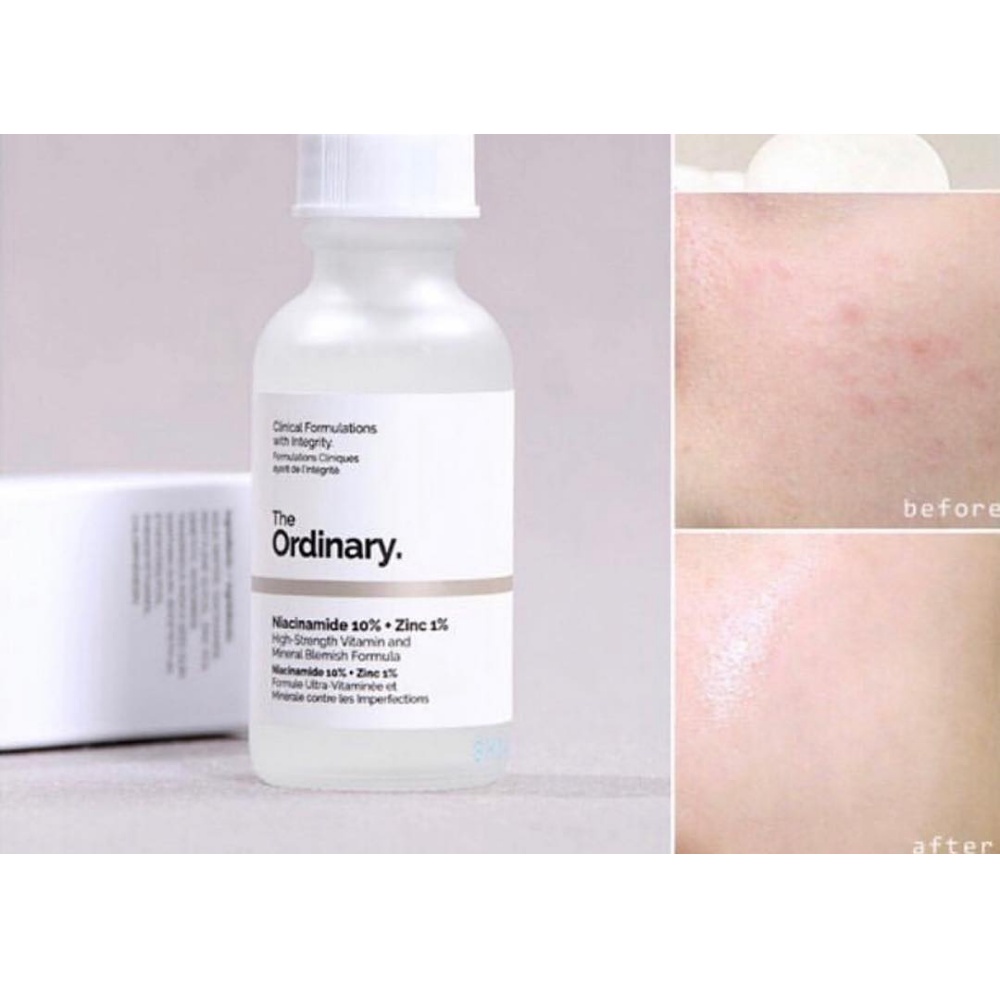 Combo Sáng Da, Cấp Nước Serum The Ordinary Niacinamide 10% + Zinc và Serum Hyaluronic Acid 2% + B5 - Cila House