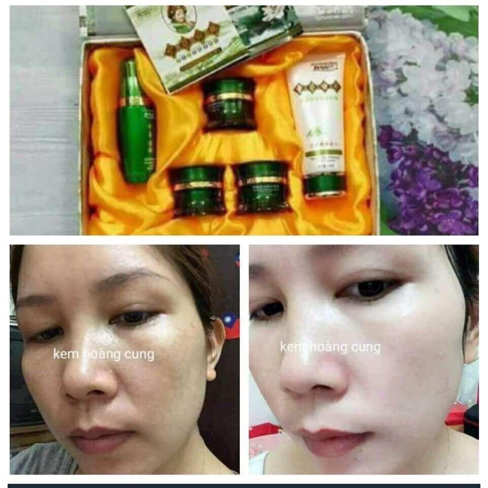 Bộ Kem Hoàng Cung Xanh 5 Món | BigBuy360 - bigbuy360.vn