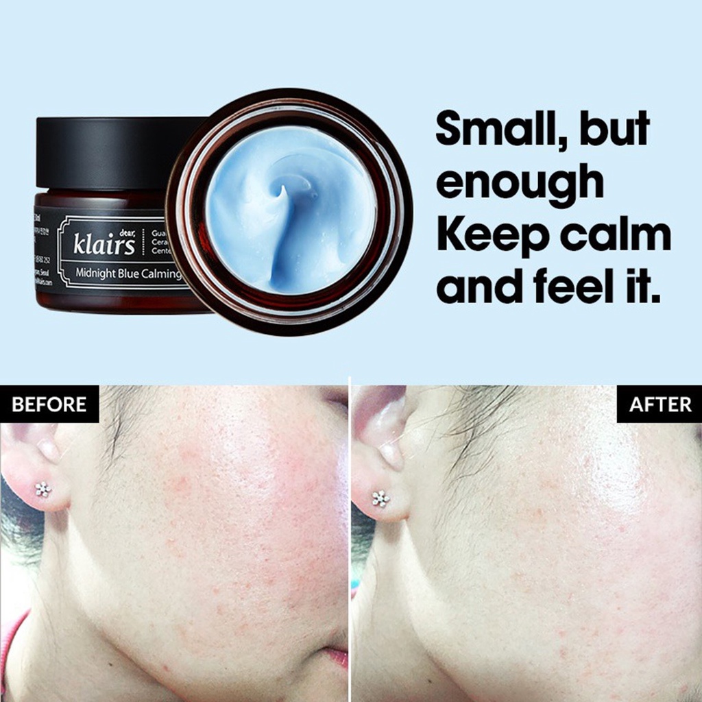 Kem Dưỡng Dear Klairs Midnight Blue Calming Cream 30ml - San Beauty
