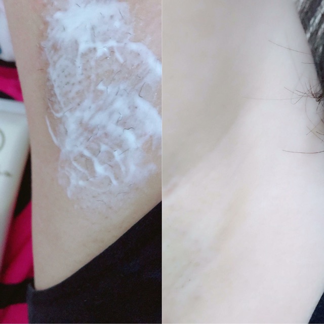 KEM TRIỆT LÔNG MY MIU | BigBuy360 - bigbuy360.vn