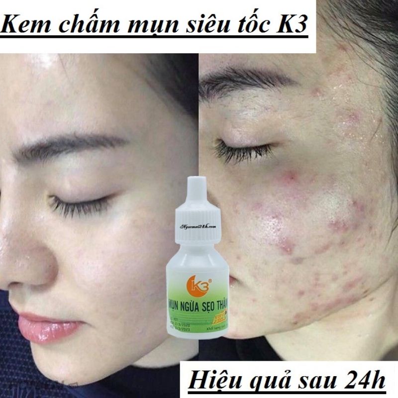 Kem chấm mụn siêu tốc 24h k3 hủ 12g