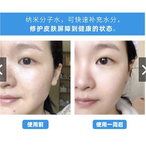 Nước hoa hồng cấp nước Orien NanoH2O (Nhật) - tinh khiến, ko cồn, ko hương liệu, ko parapne, ko scs,... | BigBuy360 - bigbuy360.vn