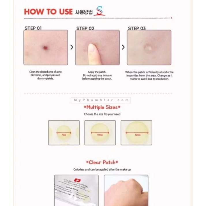 Miếng Dán Mụn Ciracle Red Spot Acne Pimple Patch