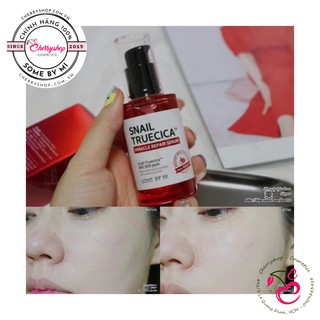 Tinh chất làm mờ sẹo, dưỡng trắng some by mi snail truecica miracle repair 50ml