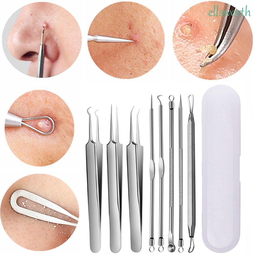Set dụng cụ nặn mụn đầu đen bằng thép không gỉ thiết kế chuyên nghiệp kèm túi đựng