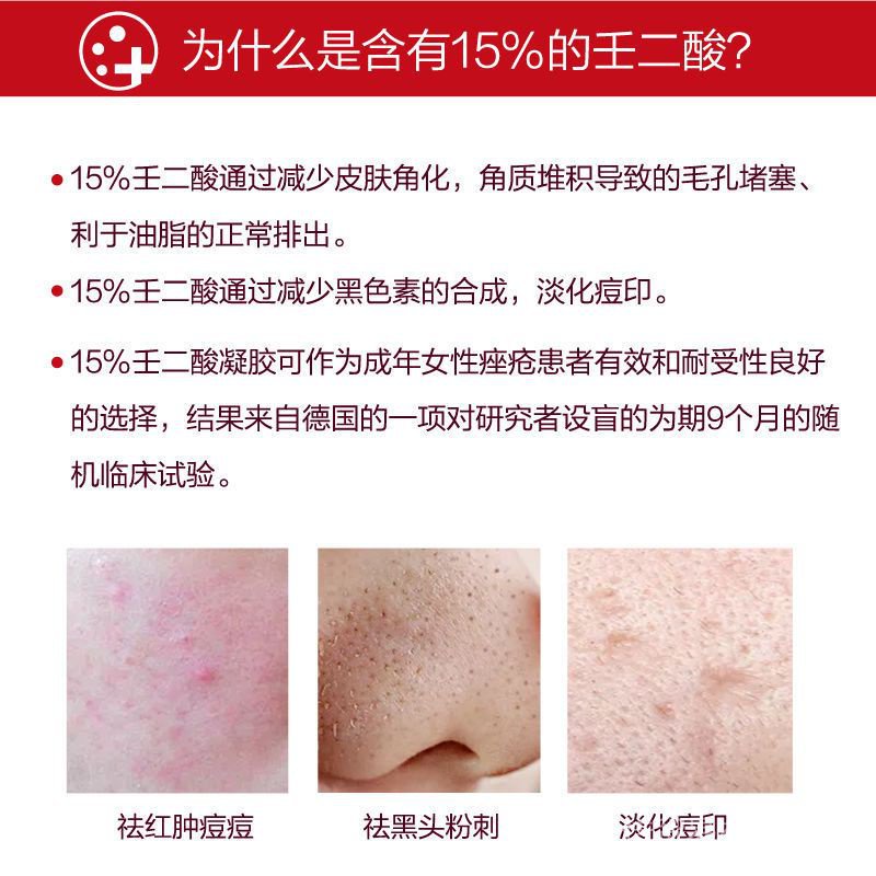 Lotion chứa 15% azelaic acid dưỡng ẩm làm sạch da 15g