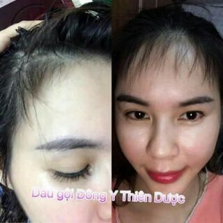 Dầu gội Đông y thiên dược