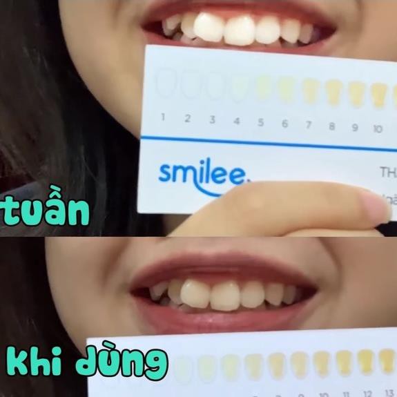 Smilee Extra, Smilee Max - Máy làm trắng răng không ê buốt, làm trắng 3-6 tone, xuất xứ USA