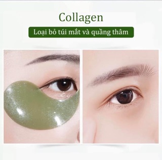 Mặt nạ mắt