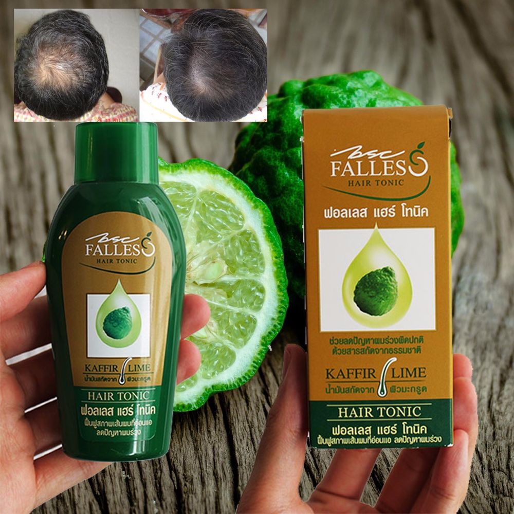 Nước dưỡng ngăn rụng tóc Falless (90ml)