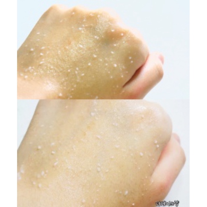 Tẩy Ngọc Trai Smart Peeling White Jewel Perie