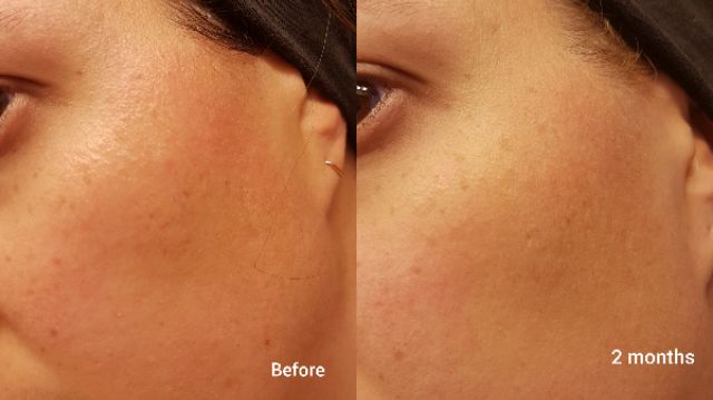 Bill Canada Niod serum phục hồi da Modulating Glucosides