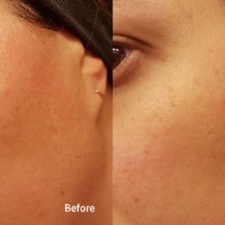 bill Canada Niod MG serum phục hồi da Modulating Glucosides