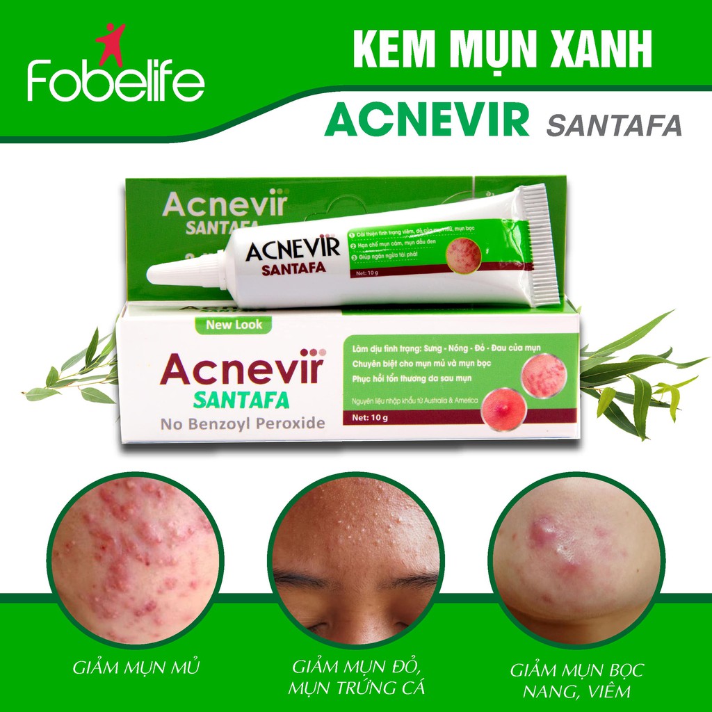 Kem Giảm Mụn Mủ, Mụn Bọc, Mụn Đỏ Và Mụn Trứng Cá  Acnevir Santafa ( Xanh ) tuýp 10gr- Đạt chuẩn GMP | BigBuy360 - bigbuy360.vn