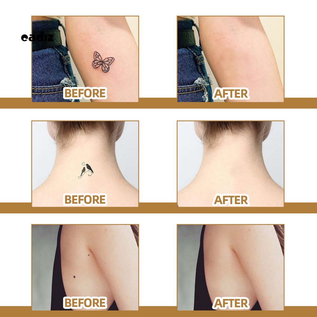 Miếng Dán Hỗ trợ giảm sẹo Dịu Nhẹ Cho Nữ