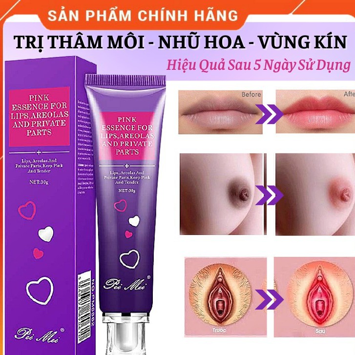 Chống Thâm Môi - Làm Hồng Nhũ Hoa - Vùng Kín Pei Mei